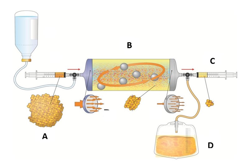 dimostrazione terapia Lipogems